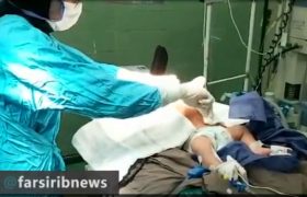ویدئو: موفقیت نادرترین عمل جراحی مغز در شیراز