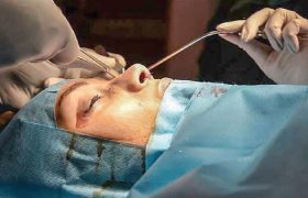 عمل زیبایی در منزل مسکونی، یک شهروند را تا پای مرگ کشاند